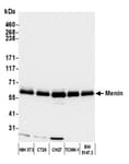 Detection of mouse Menin by western blot.