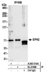 Detection of human EPN2 by western blot of immunoprecipitates.