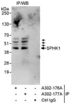 Detection of human SPHK1 by western blot of immunoprecipitates.
