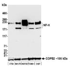Detection of mouse NF-H by western blot.