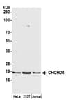 Detection of human CHCHD4 by western blot.