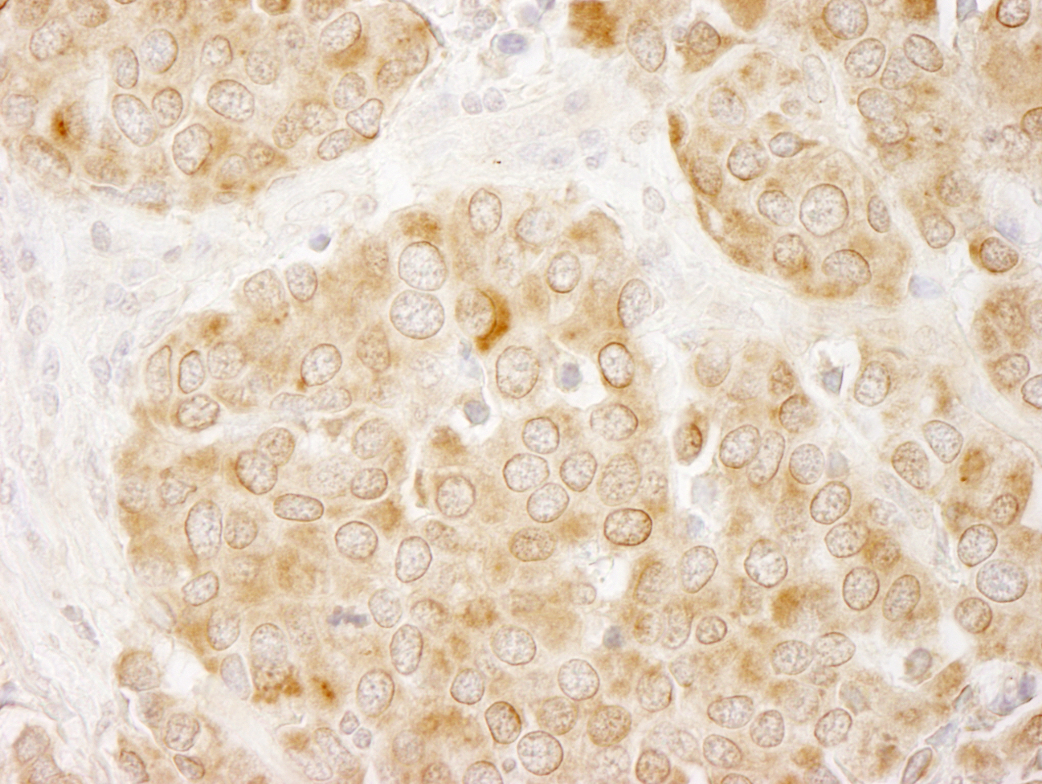 Rabbit anti-IRS1 IHC Antibody