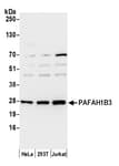 Detection of human PAFAH1B3 by western blot.