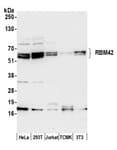 Detection of human and mouse RBM42 by western blot.