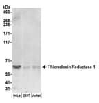 Detection of human Thioredoxin Reductase 1 by western blot.
