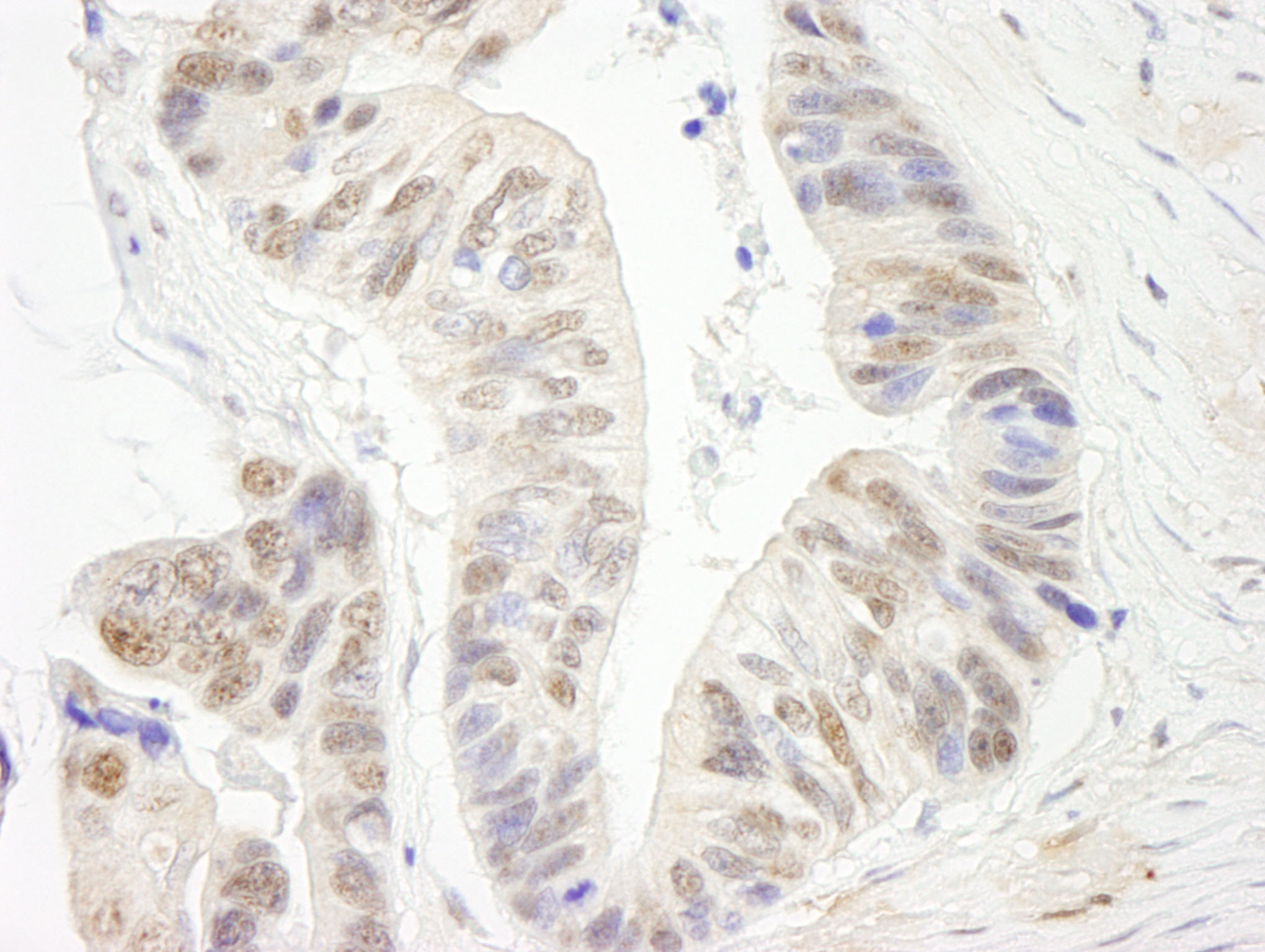 Rabbit anti-ERCC5/XPG IHC Antibody