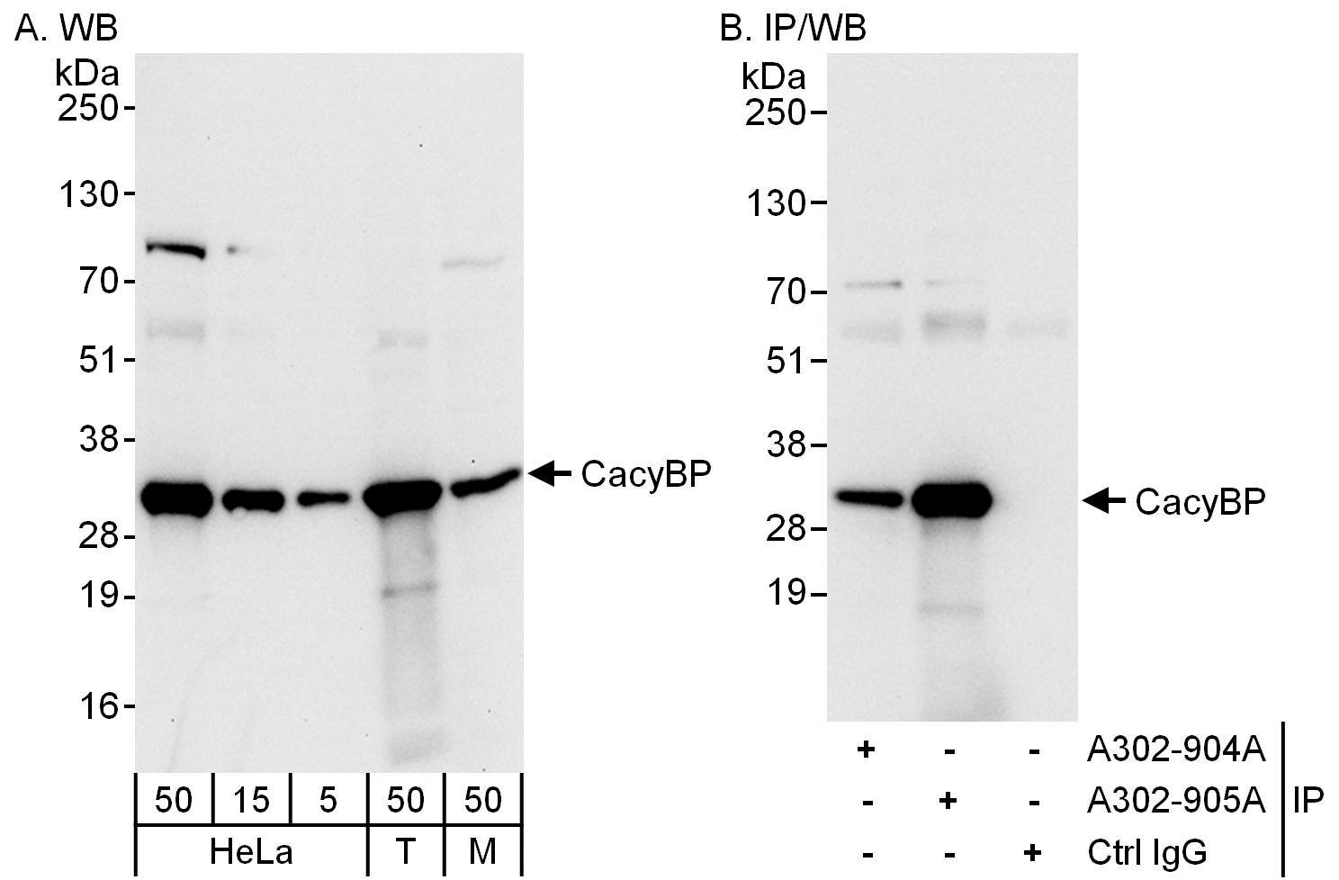 Detection of human and mouse CacyBP by western blot (h&amp;m) and immunoprecipitation (h).
