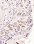 Detection of human GR by immunohistochemistry.
