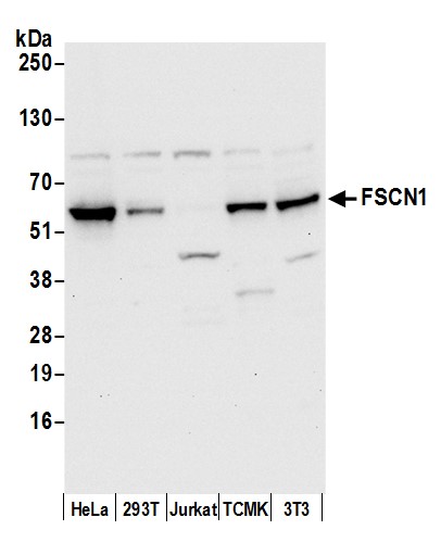 Detection of human and mouse FSCN1 by western blot.