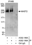 Detection of human MAST2 by western blot of immunoprecipitates.