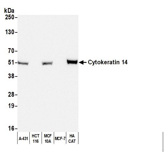 Detection of human Cytokeratin 14 by western blot with Affinity Purified Goat anti-Mouse IgG3 Heavy Chain Antibody.