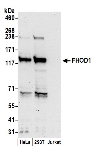 Detection of human FHOD1 by western blot.