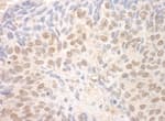Detection of human TDRD3 by immunohistochemistry.