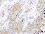 Detection of mouse CCT2 by immunohistochemistry.