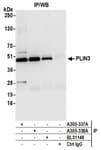Detection of human PLIN3 by western blot of immunoprecipitates.