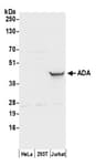 Detection of human ADA by western blot.