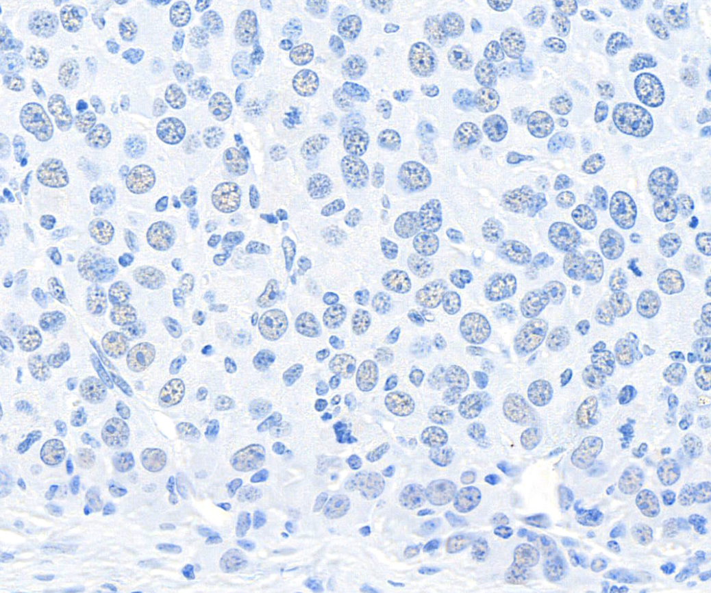 Detection of mouse CPSF160 by immunohistochemistry.