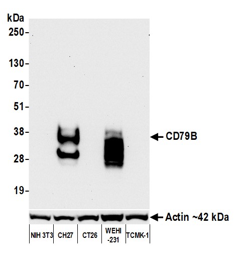 Detection of mouse CD79B by western blot.