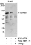 Detection of human CKAP2 by western blot of immunoprecipitates.