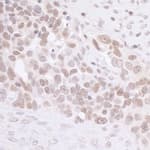 Detection of human MIS12 by immunohistochemistry.
