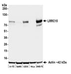 Detection of human LRRC15 by western blot.