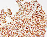 Detection of human SMARCB1/SNF5/INI1 by immunohistochemistry.