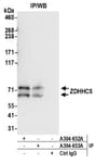 Detection of human ZDHHC5 by western blot of immunoprecipitates.