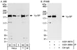 Detection of human and mouse VprBP by western blot (h&amp;m) and immunoprecipitation (h).