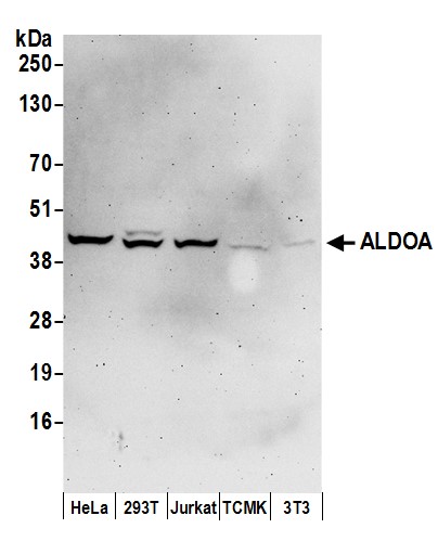 Detection of human ALDOA by western blot.