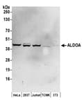 Detection of human ALDOA by western blot.