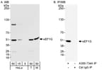 Detection of human and mouse eEF1G by western blot (h&amp;m) and immunoprecipitation (h).