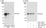 Detection of human SOX2 by western blot and immunoprecipitation.