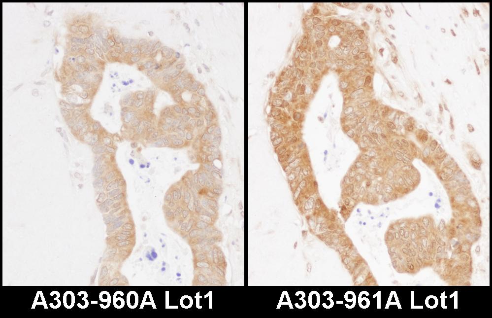 Detection of human MARS by immunohistochemistry.