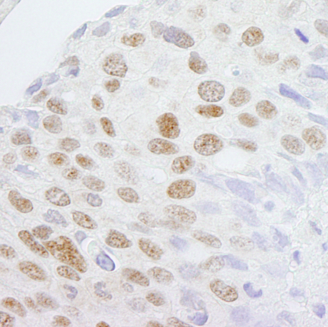Rabbit anti-ZCCHC8 IHC Antibody