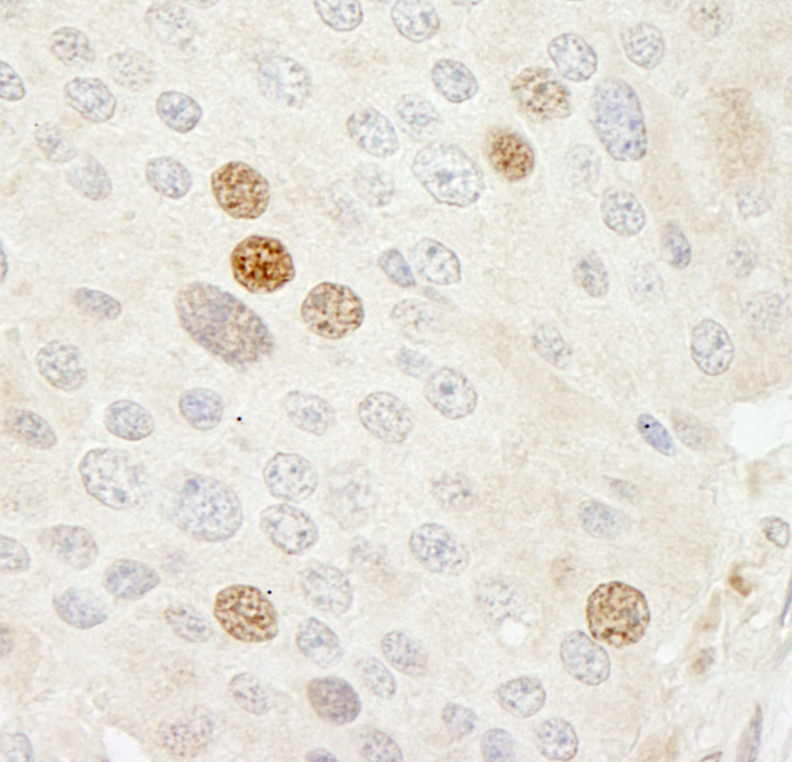 Rabbit anti-CDK2 IHC Antibody