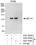 Detection of human GEF-H1 by western blot of immunoprecipitates.