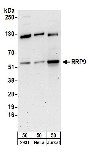 Detection of human RRP9 by western blot.