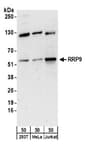 Detection of human RRP9 by western blot.