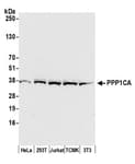Detection of human and mouse PPP1CA by western blot.