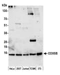 Detection of human and mouse COX5B by western blot.