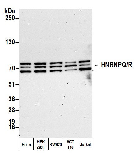 Detection of human HNRNPQ/R by western blot.