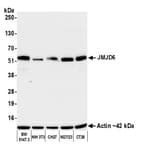 Detection of mouse JMJD6 by western blot.