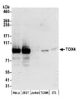 Detection of human and mouse TOX4 by western blot.