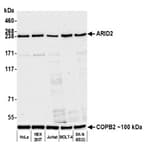 Detection of human ARID2 by western blot.