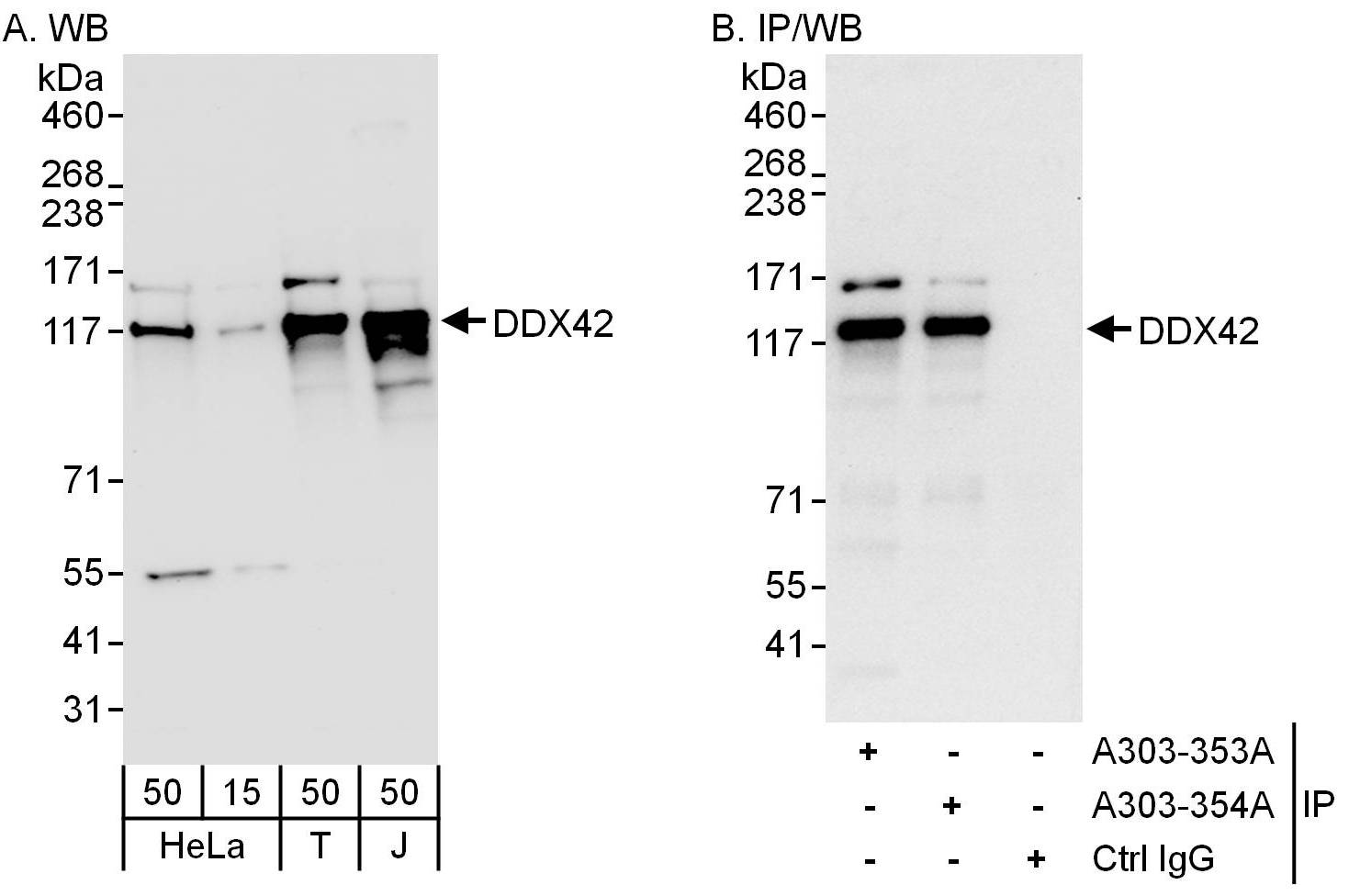 Detection of human DDX42 by western blot and immunoprecipitation.