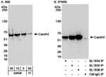Detection of human CamK4 by western blot and immunoprecipitation.
