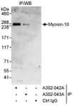 Detection of human Myosin-10 by western blot of immunoprecipitates.