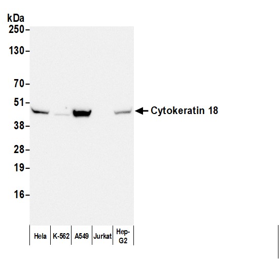 Detection of human Cytokeratin 18 by western blot with Affinity Purified Goat anti-Mouse IgG1 Cross-Adsorbed Antibody.