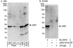 Detection of human and mouse DRP by western blot (h&amp;m) and immunoprecipitation (h).