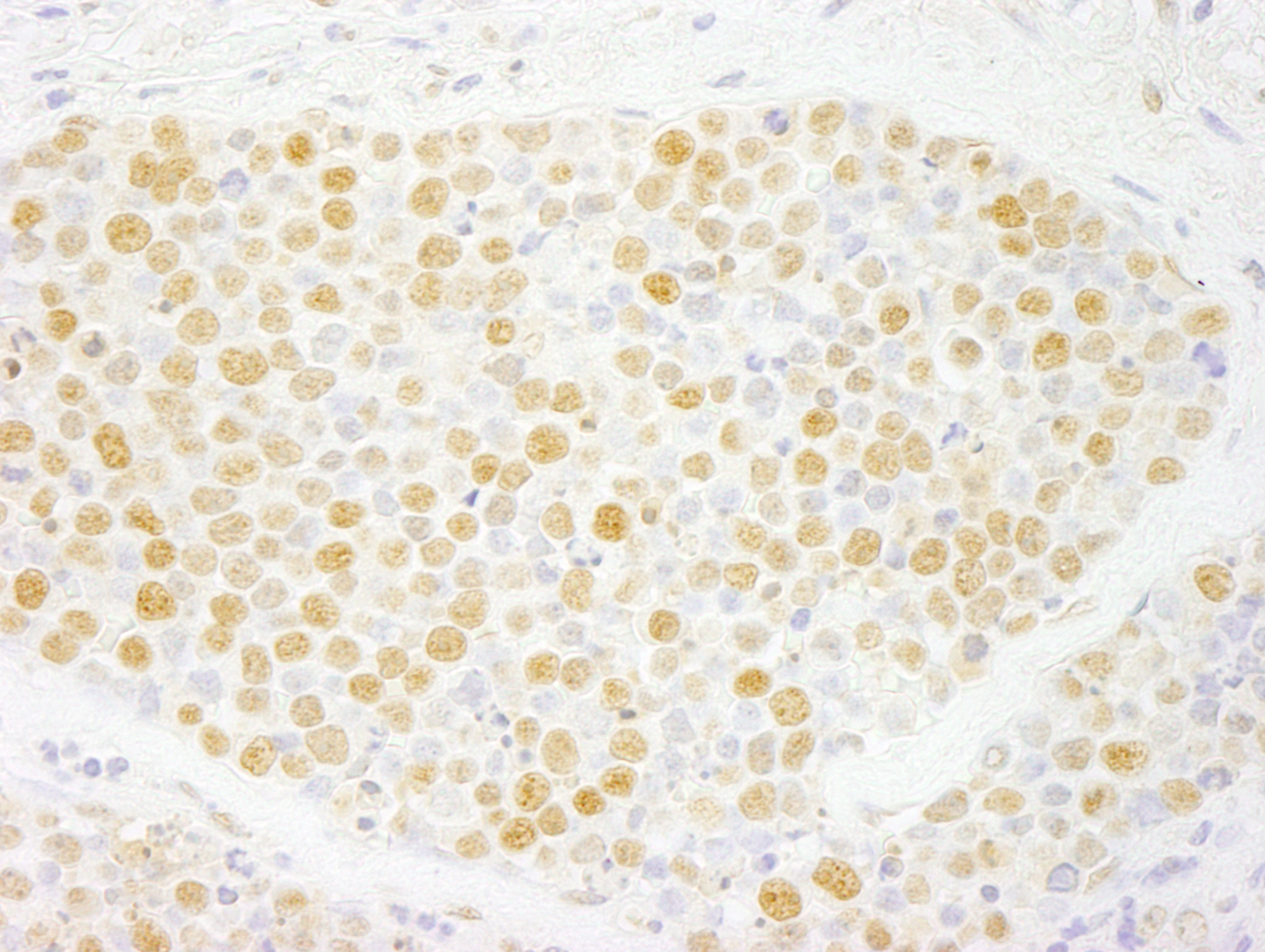 Rabbit anti-ZNF198 IHC Antibody